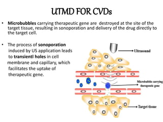 UTMD FOR CVDs
• Microbubbles carrying therapeutic gene are destroyed at the site of the
target tissue, resulting in sonoporation and delivery of the drug directly to
the target cell.
• The process of sonoporation
induced by US application leads
to transientl holes in cell
membrane and capillary, which
facilitates the uptake of
therapeutic gene.
 