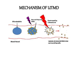 MECHANISM OF UTMD
 