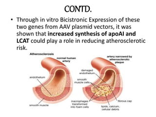 CONTD.
• Through in vitro Bicistronic Expression of these
two genes from AAV plasmid vectors, it was
shown that increased synthesis of apoAI and
LCAT could play a role in reducing atherosclerotic
risk.
 