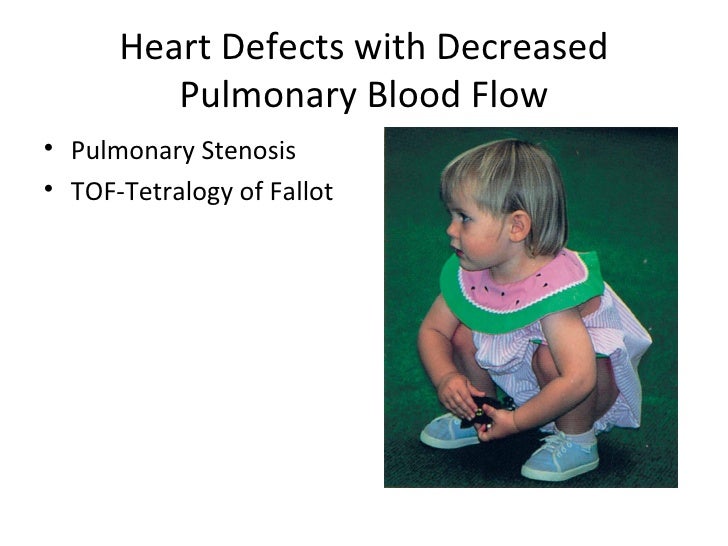 Cardiovascular disorders