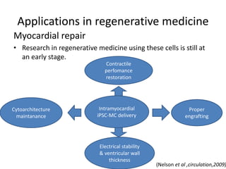 Applications in regenerative medicine
Myocardial repair
• Research in regenerative medicine using these cells is still at
an early stage.
Intramyocardial
iPSC-MC delivery
Proper
engrafting
Cytoarchitecture
maintanance
Contractile
perfomance
restoration
Electrical stability
& ventricular wall
thickness
(Nelson et al ,circulation,2009)
 
