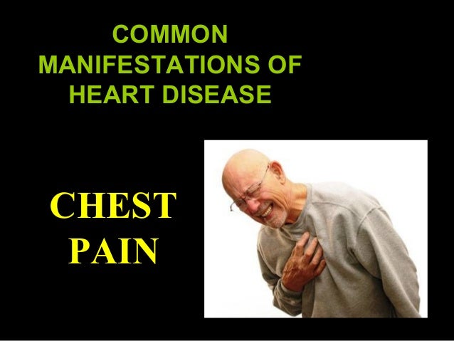 Image result for patient describing a heart attack with clenched fist in chest