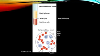 13
Copyright © The McGraw-Hill Companies, Inc. Permission required for reproduction or display.
Centrifuged Blood Sample
Peripheral Blood Smear
Liquid (plasma)
“Buffy coat” white blood cells and platelets)
Red blood cells
Red blood cells
Platelets
White
blood
cells
 