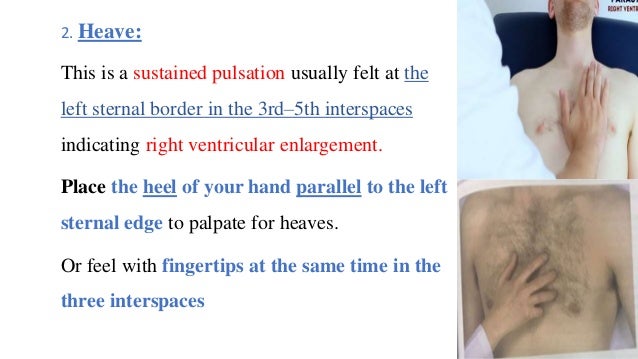 Cardiovascular Examination cardiovascular-examination