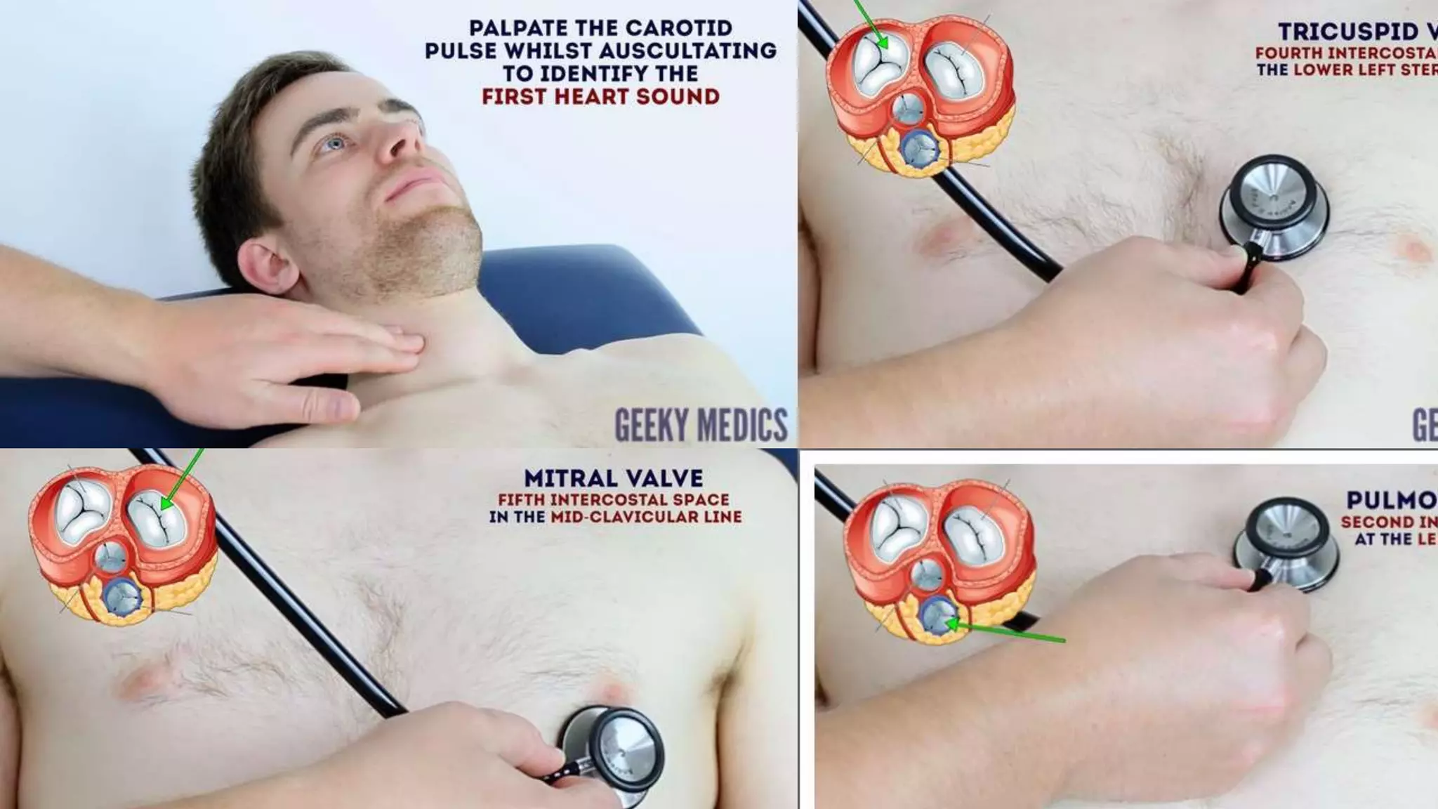 STEPS IN CARDIOVASCULAR EXAMINATION visual data 4