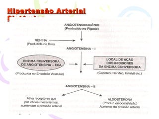 Hipertensão Arterial Sistêmica 