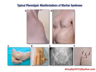 drtoufiq19711@yahoo.com
 