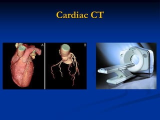 Cardiac CT
 