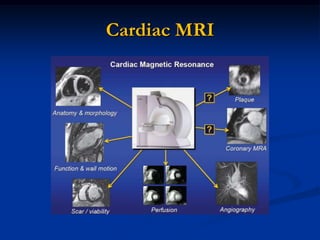 Cardiac MRI
 