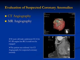 Evaluation of Suspected Coronary Anomalies

   CT Angiography
   MR Angiography



    50 years old male underwent CCA for
    FC III angina but RCA could not be
    engaged
    The patient was referred for CT
    Angiography for suspected coronary
    anomaly
 