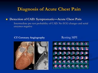 Diagnosis of Acute Chest Pain
   Detection of CAD: Symptomatic—Acute Chest Pain
      Intermediate pre-test probability of CAD. No ECG changes and serial
      enzymes negative



      CT Coronary Angiography                   Resting MPI
 
