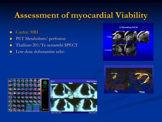 Assessment of myocardial Viability
   Cardiac MRI
   PET Metabolism/ perfusion
   Thallium 201/Tc-sestamibi SPECT
   Low dose dobutamine echo
 