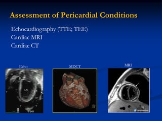 Assessment of Pericardial Conditions
Echocardiography (TTE; TEE)
Cardiac MRI
Cardiac CT


  Echo              MDCT        MRI
 