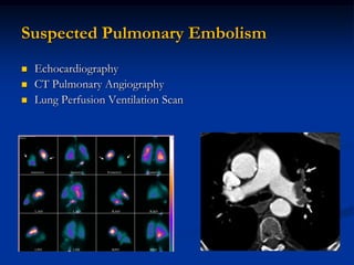Suspected Pulmonary Embolism
   Echocardiography
   CT Pulmonary Angiography
   Lung Perfusion Ventilation Scan
 