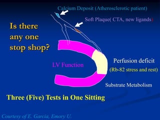 Calcium Deposit (Atherosclerotic patient)

                                    Soft Plaque( CTA, new ligands)
   Is there
   any one
   stop shop?
                                                 Perfusion deficit
                      LV Function
                                               (Rb-82 stress and rest)

                                             Substrate Metabolism

  Three (Five) Tests in One Sitting

Courtesy of E. Garcia, Emory U.
 