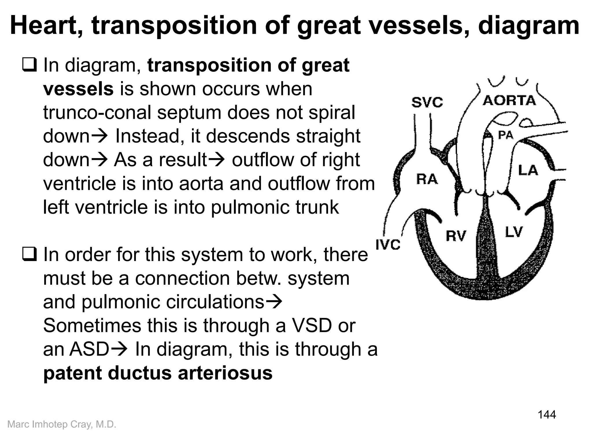 Marc Imhotep Cray, M.D.
Heart, transposition of great vessels, diagram
144
 In diagram, transposition of great
vessels is shown occurs when
trunco-conal septum does not spiral
down Instead, it descends straight
down As a result outflow of right
ventricle is into aorta and outflow from
left ventricle is into pulmonic trunk
 In order for this system to work, there
must be a connection betw. system
and pulmonic circulations
Sometimes this is through a VSD or
an ASD In diagram, this is through a
patent ductus arteriosus
 