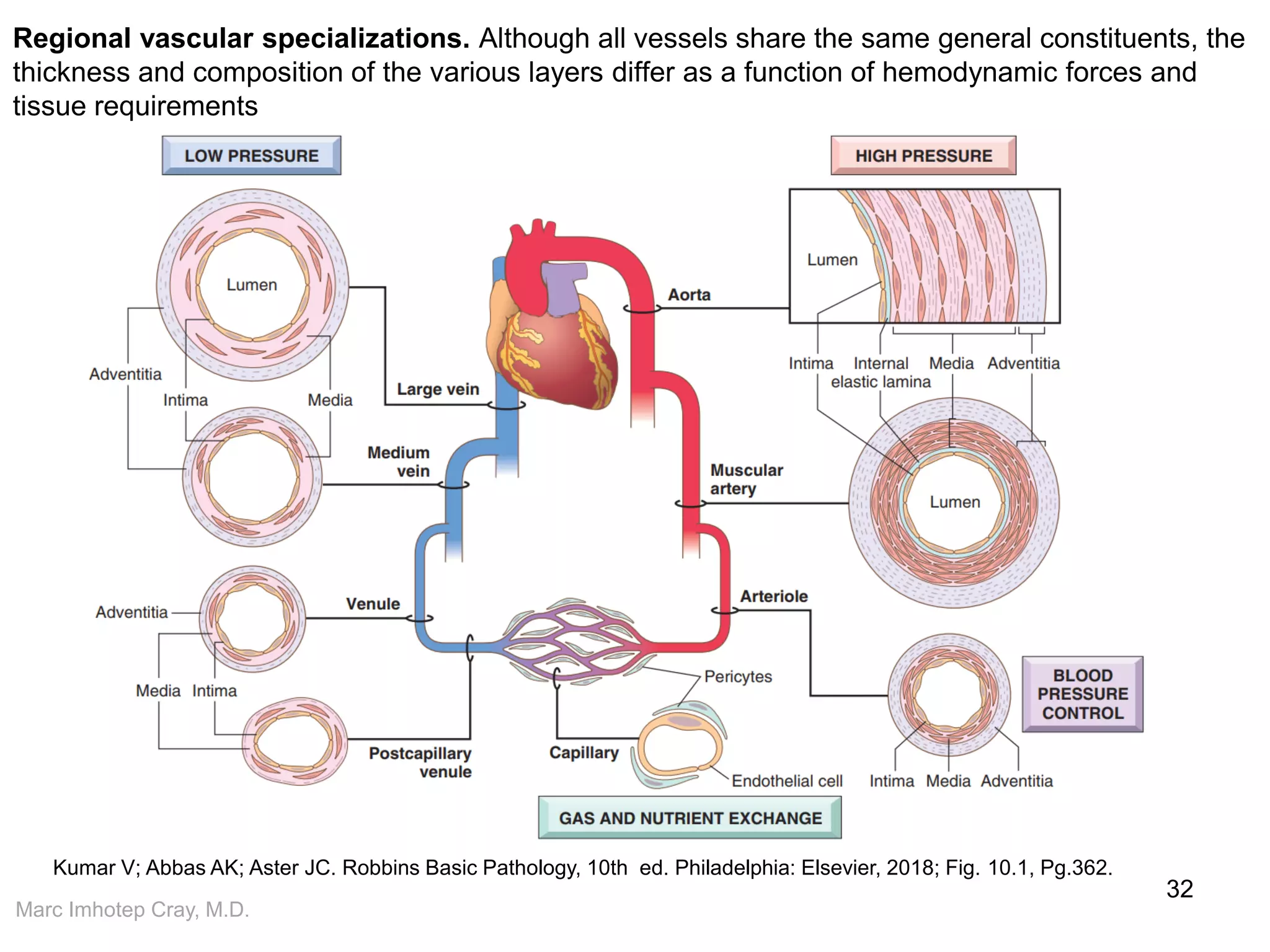 Marc Imhotep Cray, M.D.
Regional vascular specializations. Although all vessels share the same general constituents, the
thickness and composition of the various layers differ as a function of hemodynamic forces and
tissue requirements
32
Kumar V; Abbas AK; Aster JC. Robbins Basic Pathology, 10th ed. Philadelphia: Elsevier, 2018; Fig. 10.1, Pg.362.
 