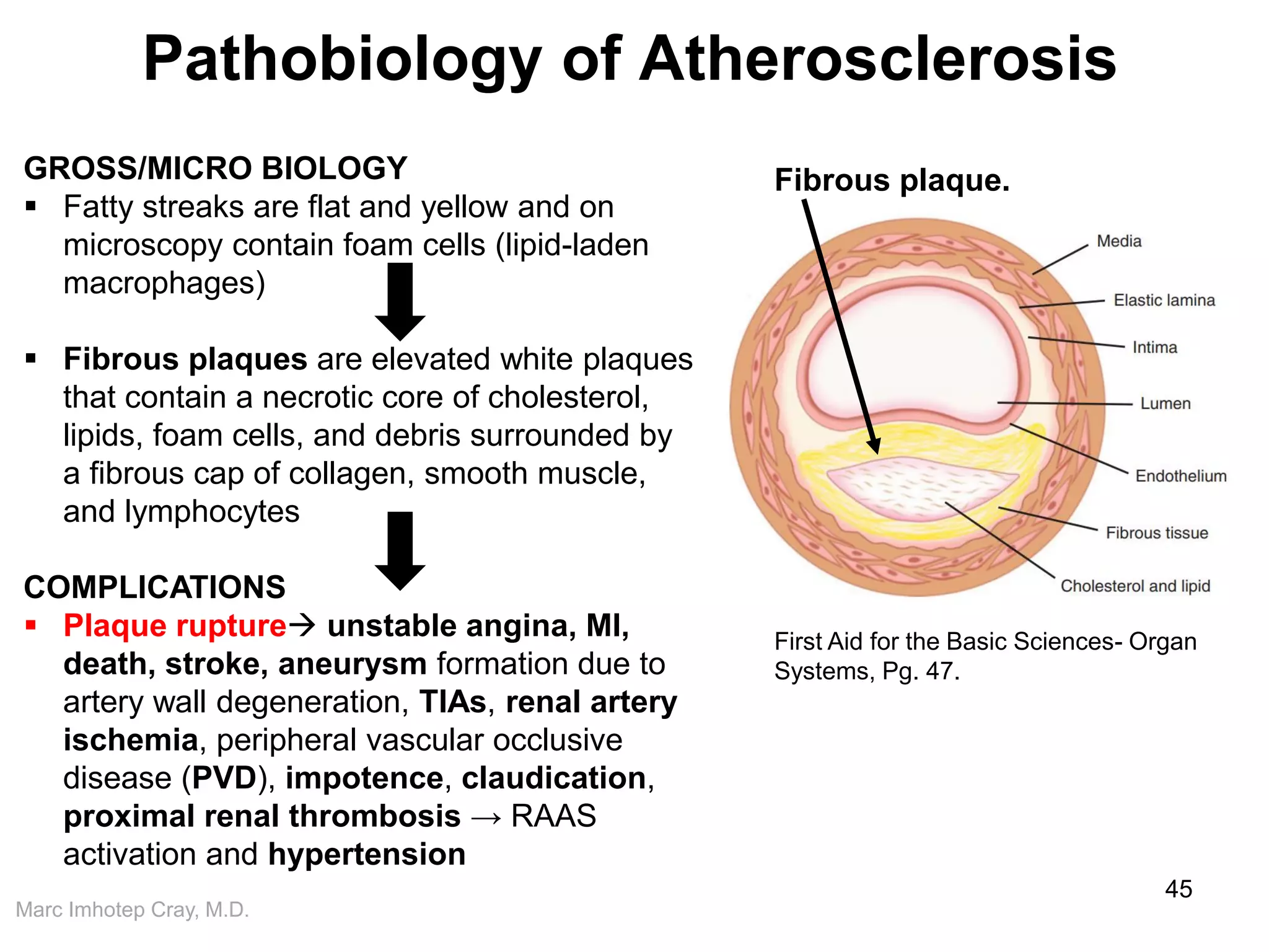 Marc Imhotep Cray, M.D.
Pathobiology of Atherosclerosis
45
GROSS/MICRO BIOLOGY
 Fatty streaks are flat and yellow and on
microscopy contain foam cells (lipid-laden
macrophages)
 Fibrous plaques are elevated white plaques
that contain a necrotic core of cholesterol,
lipids, foam cells, and debris surrounded by
a fibrous cap of collagen, smooth muscle,
and lymphocytes
COMPLICATIONS
 Plaque rupture unstable angina, MI,
death, stroke, aneurysm formation due to
artery wall degeneration, TIAs, renal artery
ischemia, peripheral vascular occlusive
disease (PVD), impotence, claudication,
proximal renal thrombosis → RAAS
activation and hypertension
First Aid for the Basic Sciences- Organ
Systems, Pg. 47.
Fibrous plaque.
 