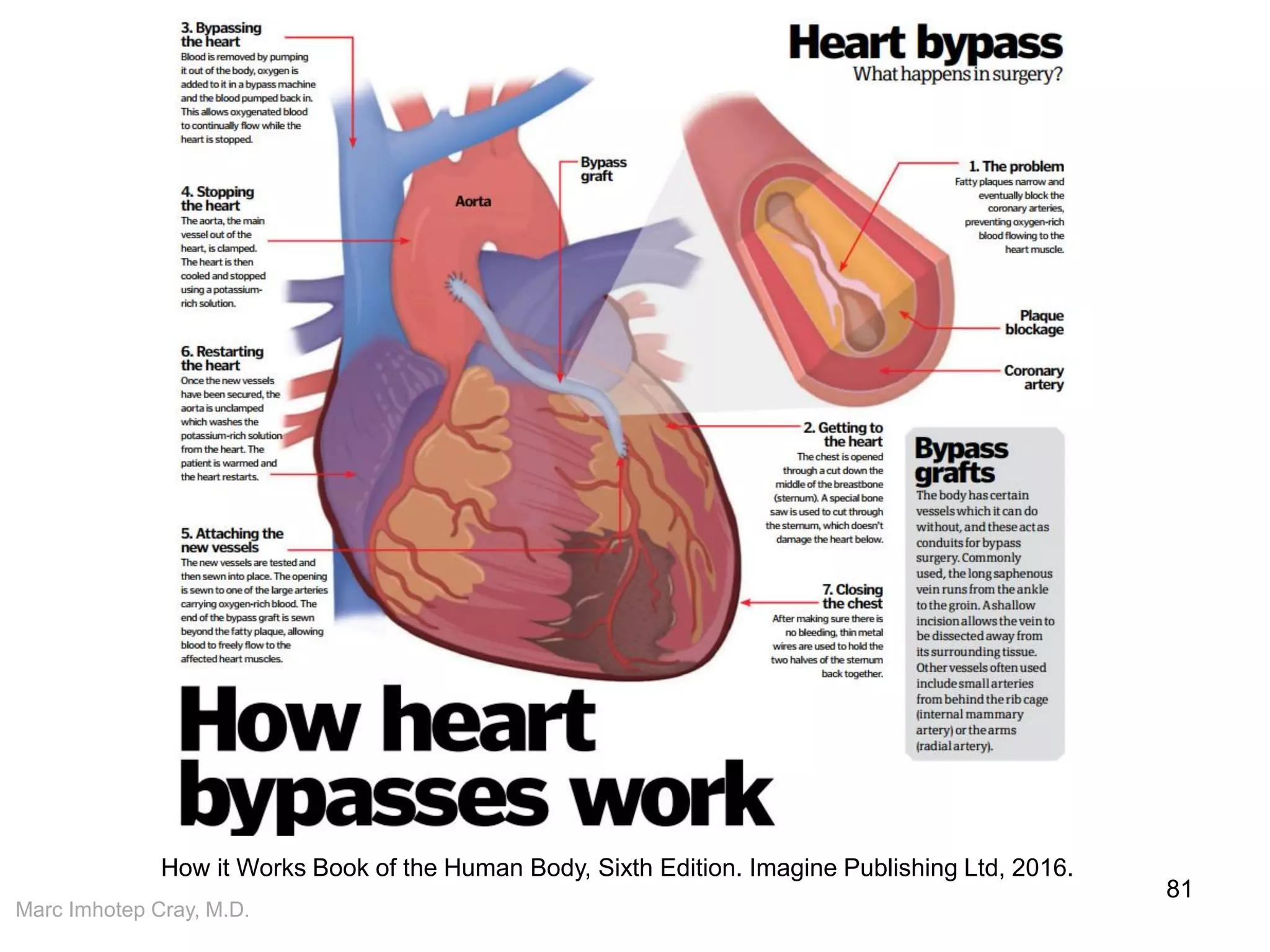 Marc Imhotep Cray, M.D.
81
How it Works Book of the Human Body, Sixth Edition. Imagine Publishing Ltd, 2016.
 