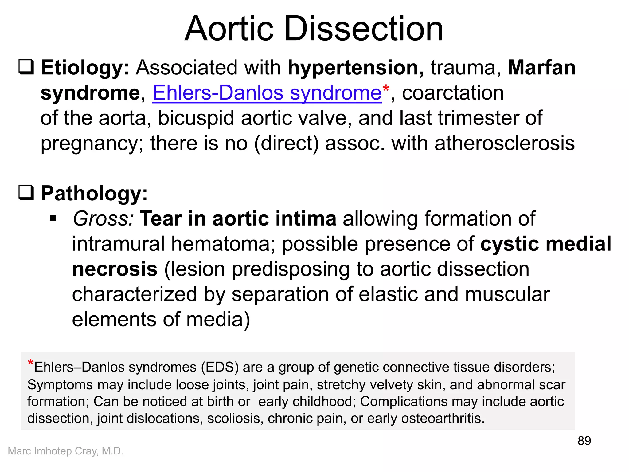 Marc Imhotep Cray, M.D.
Aortic Dissection
89
 Etiology: Associated with hypertension, trauma, Marfan
syndrome, Ehlers-Danlos syndrome*, coarctation
of the aorta, bicuspid aortic valve, and last trimester of
pregnancy; there is no (direct) assoc. with atherosclerosis
 Pathology:
 Gross: Tear in aortic intima allowing formation of
intramural hematoma; possible presence of cystic medial
necrosis (lesion predisposing to aortic dissection
characterized by separation of elastic and muscular
elements of media)
*Ehlers–Danlos syndromes (EDS) are a group of genetic connective tissue disorders;
Symptoms may include loose joints, joint pain, stretchy velvety skin, and abnormal scar
formation; Can be noticed at birth or early childhood; Complications may include aortic
dissection, joint dislocations, scoliosis, chronic pain, or early osteoarthritis.
 