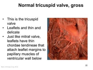 Cardiovascular Pathology Case-based_Gross and Microscopic | PDF