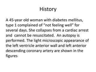 History
A 45-year old woman with diabetes mellitus,
type 1 complained of “not feeling well” for
several days. She collapses from a cardiac arrest
and cannot be resuscitated. An autopsy is
performed. The light microscopic appearance of
the left ventricle anterior wall and left anterior
descending coronary artery are shown in the
figures
 