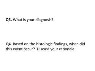 Q3. What is your diagnosis?
Q4. Based on the histologic findings, when did
this event occur? Discuss your rationale.
 