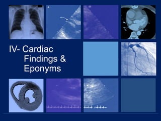 IV- Cardiac
Findings &
Eponyms
 