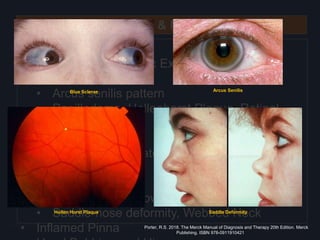Head & Neck
Inspection
• Eye and Fundoscopic Examination
• Blue sclerae
• Arcus senilis pattern
• Papilledema, Hollenhorst Plaque, Retinal
Occlusion
• Oral Examination
• High-arched Palate, Bifid Uvula, Orange
Tonsils
• Dysmorphisms
• Hypertelorism, Low-set ears, or Micrognathia
• Saddle-nose deformity, Webbed Neck
• Inflamed Pinna
Blue Sclerae Arcus Senilis
Hollen Horst Plaque Saddle Deformity
Porter, R.S. 2018. The Merck Manual of Diagnosis and Therapy 20th Edition. Merck
Publishing. ISBN 978-0911910421
 