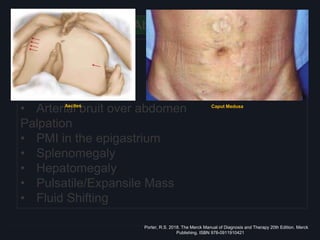 Abdomen
Inspection
• Ascites
• Caput Medusae
Auscultation
• Arterial bruit over abdomen
Palpation
• PMI in the epigastrium
• Splenomegaly
• Hepatomegaly
• Pulsatile/Expansile Mass
• Fluid Shifting
Porter, R.S. 2018. The Merck Manual of Diagnosis and Therapy 20th Edition. Merck
Publishing. ISBN 978-0911910421
Ascites Caput Medusa
 