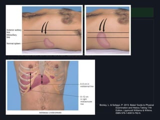 Abdomen
Inspection
• Ascites
• Caput Medusae
Auscultation
• Arterial bruit over abdomen
Palpation
• PMI in the epigastrium
• Splenomegaly
• Hepatomegaly
• Pulsatile/Expansile Mass
• Fluid Shifting
Bickley, L. & Szilagyi, P. 2013. Bates' Guide to Physical
Examination and History Taking 11th
Edition. Lippincott Williams & Wilkins.
ISBN 978-1-60913-762-5.
 