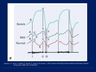 Jameson, J.L., Fauci, A., Kasper, D., Hauser, S., Longo, D. & Loscalzo, J. 2018. Harrison's Principles of Internal Medicine 20th Edition. McGraw-
Hill Education. ISBN: 978-1-25-964404-7.
 