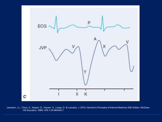 Jameson, J.L., Fauci, A., Kasper, D., Hauser, S., Longo, D. & Loscalzo, J. 2018. Harrison's Principles of Internal Medicine 20th Edition. McGraw-
Hill Education. ISBN: 978-1-25-964404-7.
 