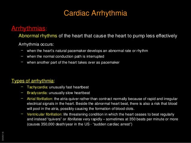 CARDIAC ARRHYTHMIAS PHARMACOLOGY PDF DOWNLOAD CARDIAC ARRHYTHMIAS PHARMACOLOGY PDF DOWNLOAD