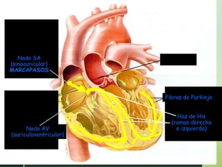 Nodo SA
(sinoauricular)
MARCAPASOS
Fibras de Purkinje
Haz de His
(ramas derecha
e izquierda)
Nodo AV
(auriculoventricular)
 