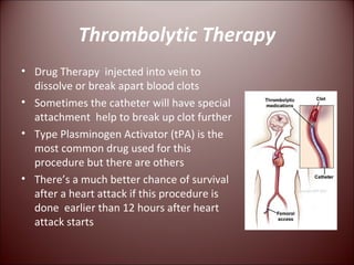 Thrombolytic Therapy Drug Therapy  injected into vein to dissolve or break apart blood clots Sometimes the catheter will have special attachment  help to break up clot further Type Plasminogen Activator (tPA) is the most common drug used for this procedure but there are others There’s a much better chance of survival after a heart attack if this procedure is done  earlier than 12 hours after heart attack starts 