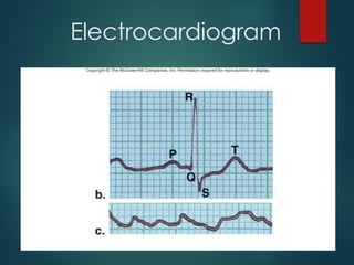 Electrocardiogram
 
