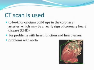 CT scan is usedto look for calcium build ups in the coronary arteries, which may be an early sign of coronary heart disease (CHD) for problems with heart function and heart valvesproblems with aorta 