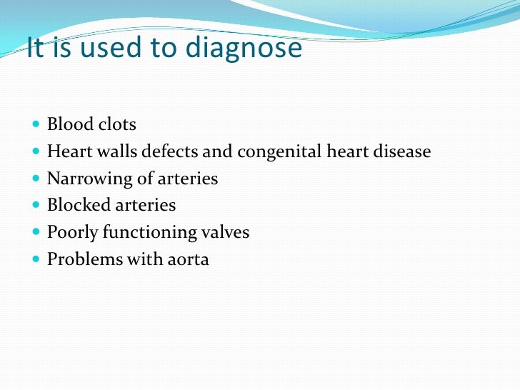 Cardiovascular system/ diagnostic tests and procedures
