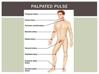 PALPATED PULSE
 