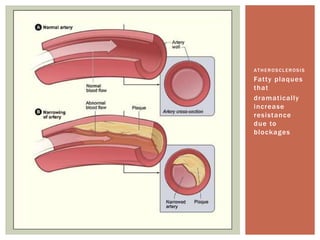 ATHEROSCLEROSIS
Fatty plaques
that
dramatically
increase
resistance
due to
blockages
 