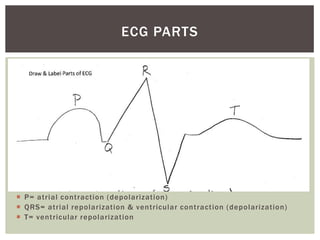 ECG PARTS




 P= atrial contraction (depolarization)
 QRS= atrial repolarization & ventricular contraction (depolarization)
 T= ventricular repolarization
 