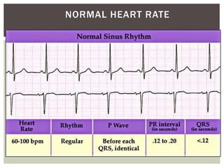 NORMAL HEART RATE
 