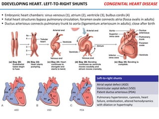 DDEVELOPING HEART. LEFT-TO-RIGHT SHUNTS
• Embryonic heart chambers: sinus venosus (1), atrium (2), ventricle (3), bulbus cordis (4)
• Fetal heart structures bypass pulmonary circulation; foramen ovale connects atria (fossa ovalis in adults)
• Ductus arteriosus connects pulmonary trunk to aorta (ligamentum arteriosum in adults); close after birth
CONGENITAL HEART DISEASE
Left-to-right shunts
Atrial septal defect (ASD)
Ventricular septal defect (VSD)
Patent ductus arteriosus (PDA)
Pulmonary hypertension, cyanosis, heart
failure, embolization, altered hemodynamics
with dilation or hypertrophy
 