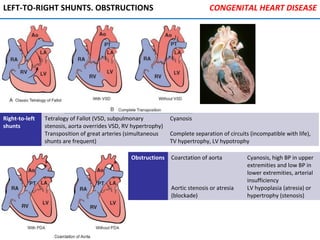 LEFT-TO-RIGHT SHUNTS. OBSTRUCTIONS
Right-to-left
shunts
Tetralogy of Fallot (VSD, subpulmonary
stenosis, aorta overrides VSD, RV hypertrophy)
Transposition of great arteries (simultaneous
shunts are frequent)
Cyanosis
Complete separation of circuits (incompatible with life),
TV hypertrophy, LV hypotrophy
Obstructions Coarctation of aorta
Aortic stenosis or atresia
(blockade)
Cyanosis, high BP in upper
extremities and low BP in
lower extremities, arterial
insufficiency
LV hypoplasia (atresia) or
hypertrophy (stenosis)
CONGENITAL HEART DISEASE
 