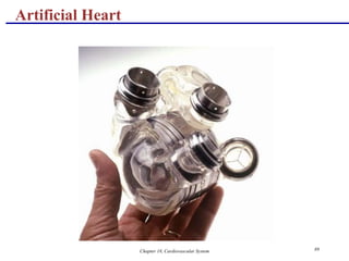 Chapter 18, Cardiovascular System 89
Artificial Heart
 