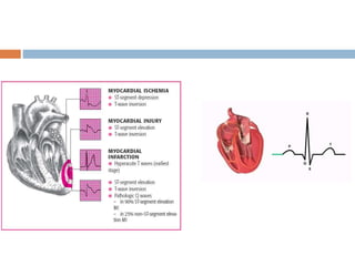 Powerchart Cardiovascular Cardiovascular_System, Pharmacotherapeutics, Second Year D. Pharm | PPTX