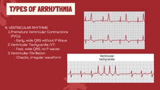 Irregular Pvc Cardiovascular System Physiology Experiment | PDF