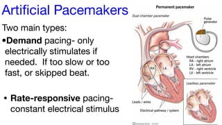 Fixed Rate Pacemaker Cardiovascular system Presentation Class Anatomy | PDF