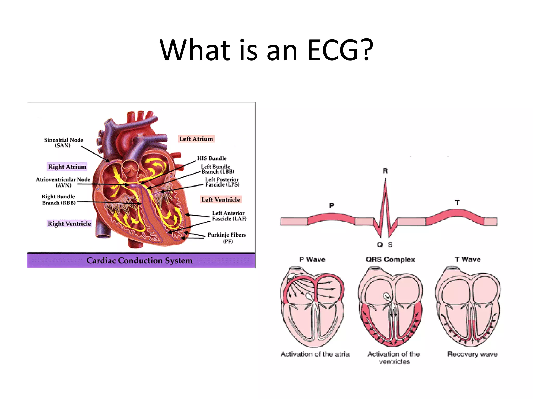 What is an ECG?
 